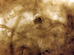 Tightly woven filamentous mat containing the stalked coccoid polybessurus